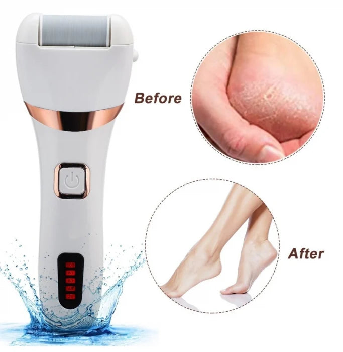 Pila electrica pentru picioare  cu indepartare eficienta a calusurilor, rezistent la apa, pentru calcaie crapate si piele uscata, ideal in pedichiura medicala, baterie durabila, ecran LCD, Set cu accesorii incluse, Alb.