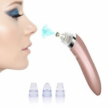 Aparat indepartat puncte negre si cosuri, cu 3 viteze de extractie.